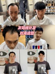 点击看大图 -极客侠男士假发定制补发