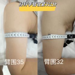 点击看大图 -Lily纤美·科技减脂中心