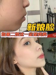 -Yestar宁波艺星整形医院