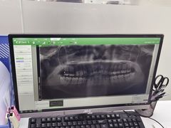 -诺贝尔一诺口腔医院(雁塔院区)