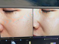-苑苑vbeauty科技美容SPA