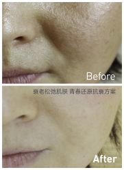 脸部抗衰-光SPA科技美肤