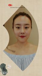 点击看大图 -北京米扬丽格医疗美容·联合丽格鼻整形中心