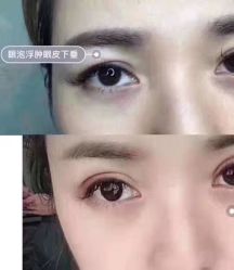 -深圳鹏爱悦心医疗美容医院
