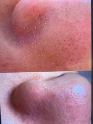 -苑苑vbeauty科技美容SPA