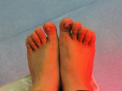 -新甲连锁灰指甲·甲沟炎·鸡眼(黑龙江路店)