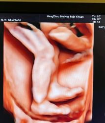 -杭州贝瑞斯美华妇儿医院·早孕·产检·儿科