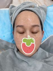 体验前-北京英煌医疗美容