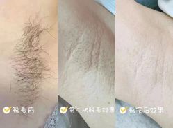 -S庆熙美学皮肤管理