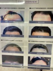 -厦门美莱整形美容医院