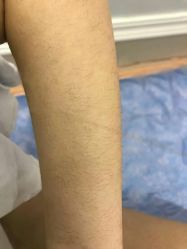 -安徽合肥韩美整形外科医院