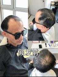 -唐风采假发补发定制