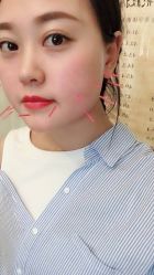 -肥三针腧穴瘦身馆