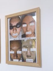 -美肤盾祛痘·问题肌头疗管理中心