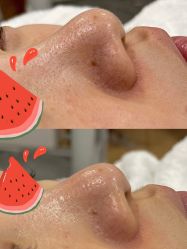 -初樱科技美学问题肌修复中心