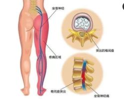-香薇妮丝·定制减肥·身材管理