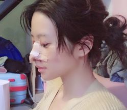 -万州华美紫馨整形美容医院