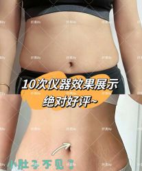 -Lily纤美·科技减脂中心