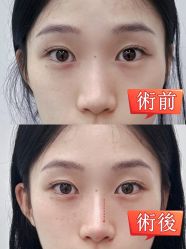 -深圳艺星医疗美容医院