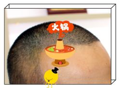 -大麦微针植发全国连锁