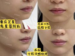 -Yestar重庆艺星医疗美容医院
