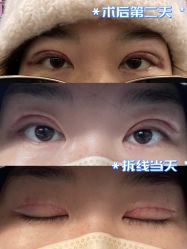 体验后-八大处整形