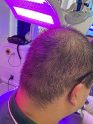 -雍禾植发全国连锁