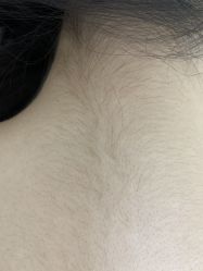 -薇兰专业脱毛连锁机构