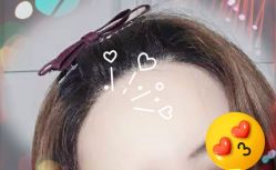 -大麦微针植发全国连锁