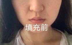 -Yestar宁波艺星整形医院
