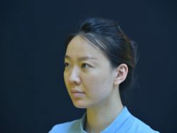 体验前-Yestar艺星整形美容医院