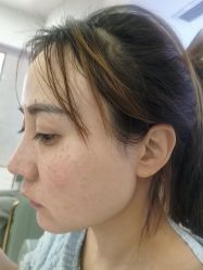 -长沙雅美医疗美容医院