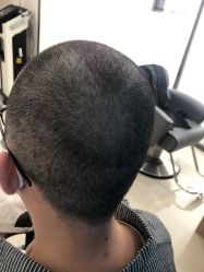 -雍禾植发全国连锁