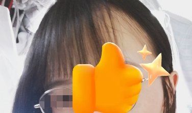 -大麦微针植发丨全国连锁