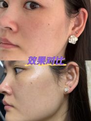 -坤如玛丽·医疗美容中心