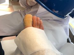 -世龙世家灰指甲鸡眼脚气甲沟炎跖疣护理(通州店)