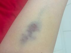 -中国人民解放军总医院