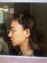 -杭州米兰柏羽医疗美容医院