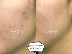 -深圳芙必优医疗美容·抗衰中心