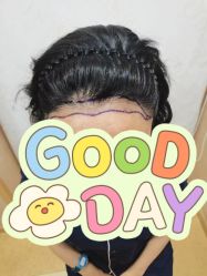 -熙朵美学植发·连锁品牌