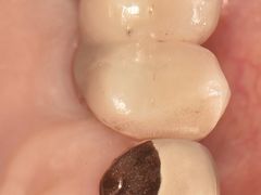 -精德口腔·种植修复·儿牙中心(财富中心店)