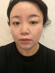 -素美医疗美容·西南眼鼻整形·修复基地
