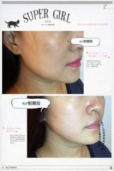 光SPA小V脸-光SPA科技美肤