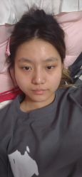 -成都西区医院整形美容
