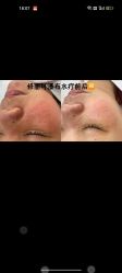 -SKIN79皮肤管理中心
