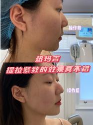 -美莱医学美容医院