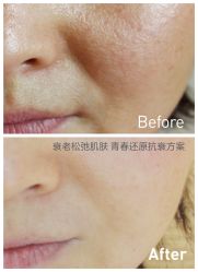 光SPA水氧+opt-光SPA科技美肤