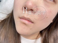 -RC半永久纹眉纹发际线