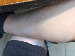 -醋缘臭屁醋养生火锅