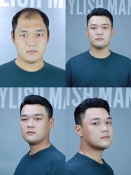 -型男帮男士假发补发·佩戴式发型